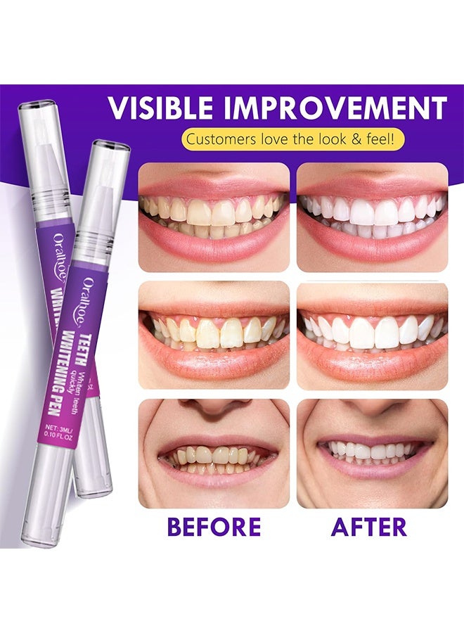 ORALHOE Teeth Whitening Pen, Teeth Whitener Kit Tooth Whitening Pen Gel Effective For Professionally Stain Removal, Painless, Low Sensitivity, No Sensitivity Snow Teeth Whitener Gel Kit For A Brighter Smile (Pack Of 2) - Image 4